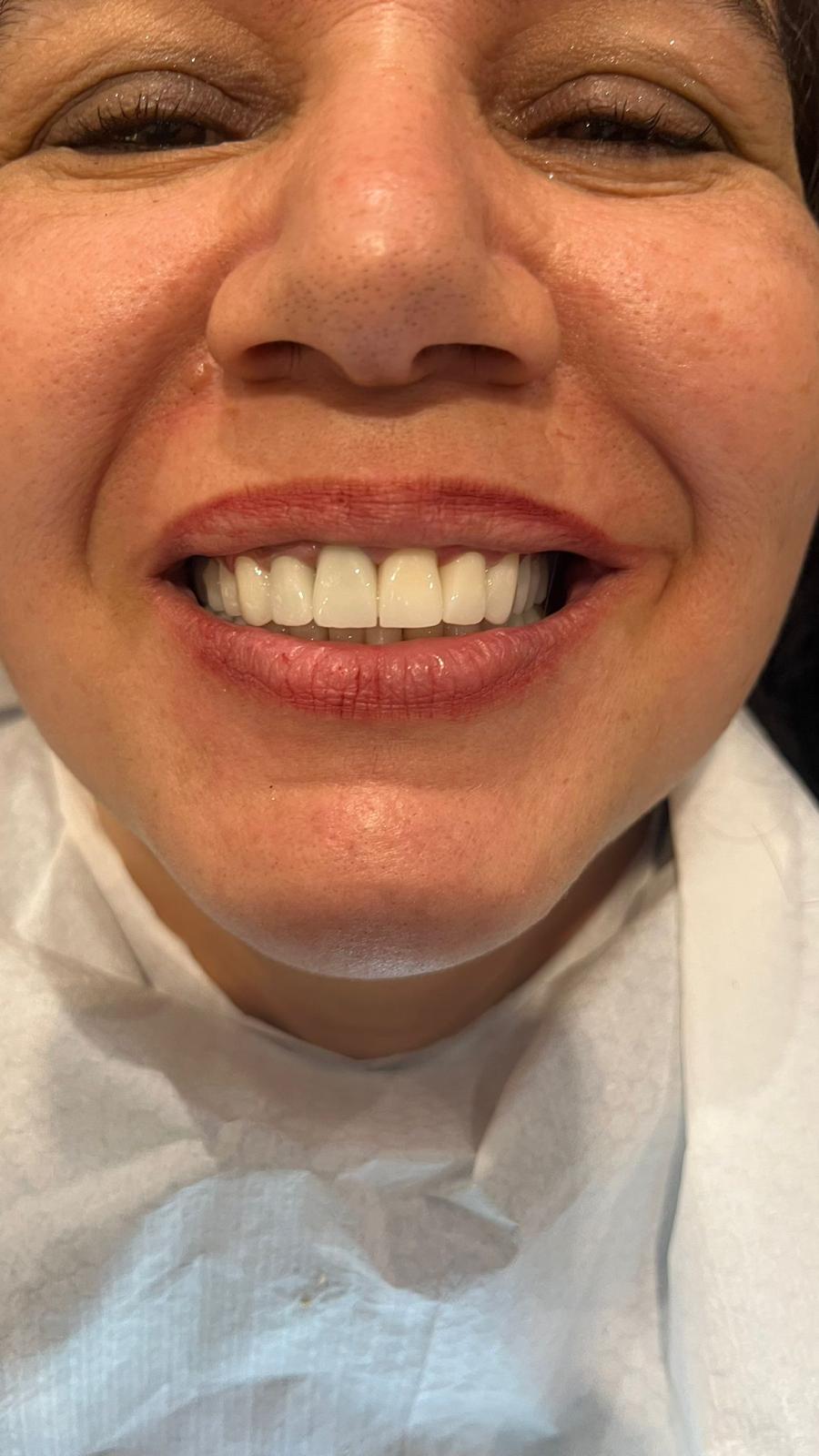 ECE Dental Patient Result